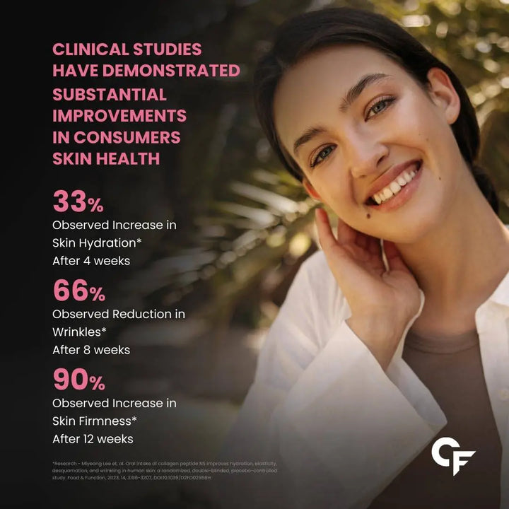 Carbamide Forte Multi Collagen Complex (Type I, II, III, V & X ) | 90 Tablets - Halt